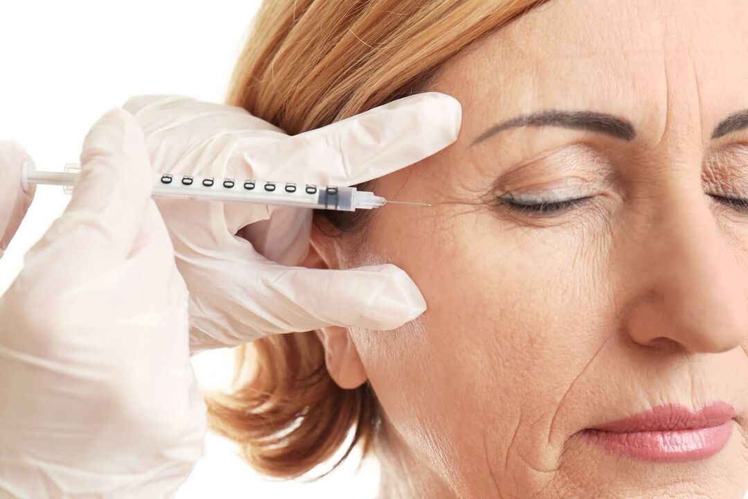 Mesotherapy is a procedure for administering drugs intradermally with a rejuvenating effect. 